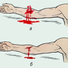 Остановим кровь, пострадавшему человеку